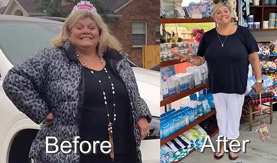 Before and After Images of Patients at NY Medical Weight Loss in Garden City, NY Before and After Images of Patients at NY Medical Weight Loss in Garden City, NY