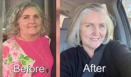 Before and After Images of Patients at NY Medical Weight Loss in Garden City, NY Before and After Images of Patients at NY Medical Weight Loss in Garden City, NY