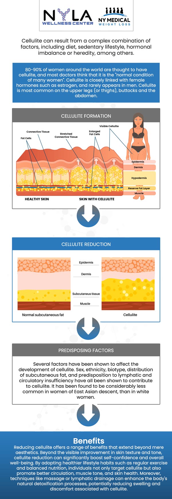 Cellulite reduction treatment is a non-invasive procedure aimed at smoothing and toning the skin while minimizing the appearance of cellulite. By targeting underlying fat deposits and enhancing circulation, these treatments help break down fat cells, tighten the skin, and improve overall texture. At NY Medical Weight Loss, our professionals are committed to helping you achieve your desired outcomes through tailored treatment plans and expert guidance. For more information, contact us or schedule an appointment online. We are conveniently located at 65 Hilton Ave #250, Garden City, NY 11530. Cellulite reduction treatment is a non-invasive procedure aimed at smoothing and toning the skin while minimizing the appearance of cellulite. By targeting underlying fat deposits and enhancing circulation, these treatments help break down fat cells, tighten the skin, and improve overall texture. At NY Medical Weight Loss, our professionals are committed to helping you achieve your desired outcomes through tailored treatment plans and expert guidance. For more information, contact us or schedule an appointment online. We are conveniently located at 65 Hilton Ave #250, Garden City, NY 11530.