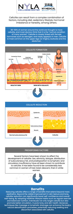 Cellulite reduction treatment is a non-invasive procedure aimed at smoothing and toning the skin while minimizing the appearance of cellulite. By targeting underlying fat deposits and enhancing circulation, these treatments help break down fat cells, tighten the skin, and improve overall texture. At NY Medical Weight Loss, our professionals are committed to helping you achieve your desired outcomes through tailored treatment plans and expert guidance. For more information, contact us or schedule an appointment online. We are conveniently located at 65 Hilton Ave #250, Garden City, NY 11530. Cellulite reduction treatment is a non-invasive procedure aimed at smoothing and toning the skin while minimizing the appearance of cellulite. By targeting underlying fat deposits and enhancing circulation, these treatments help break down fat cells, tighten the skin, and improve overall texture. At NY Medical Weight Loss, our professionals are committed to helping you achieve your desired outcomes through tailored treatment plans and expert guidance. For more information, contact us or schedule an appointment online. We are conveniently located at 65 Hilton Ave #250, Garden City, NY 11530.