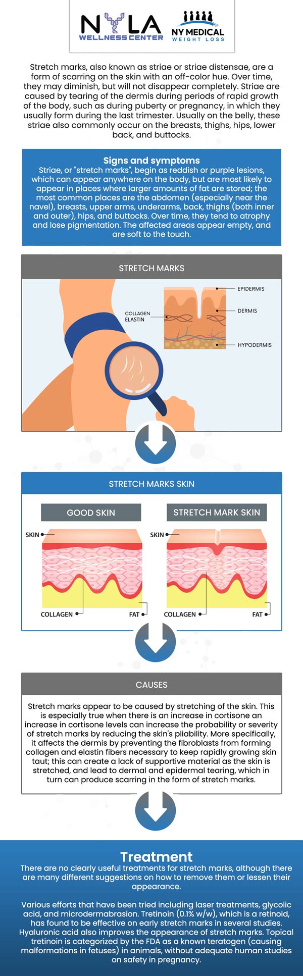 Stretch mark removal treatments are used to diminish the visibility of stretch marks, which commonly occur due to rapid skin stretching from reasons such as pregnancy, weight changes, or growth spurts. At NY Medical Weight Loss, our professional team is dedicated to supporting every step of their weight loss journey, including managing and preventing stretch marks. For more information, contact us or schedule an appointment online. We are conveniently located at 65 Hilton Ave #250, Garden City, NY 11530. Stretch mark removal treatments are used to diminish the visibility of stretch marks, which commonly occur due to rapid skin stretching from reasons such as pregnancy, weight changes, or growth spurts. At NY Medical Weight Loss, our professional team is dedicated to supporting every step of their weight loss journey, including managing and preventing stretch marks. For more information, contact us or schedule an appointment online. We are conveniently located at 65 Hilton Ave #250, Garden City, NY 11530.